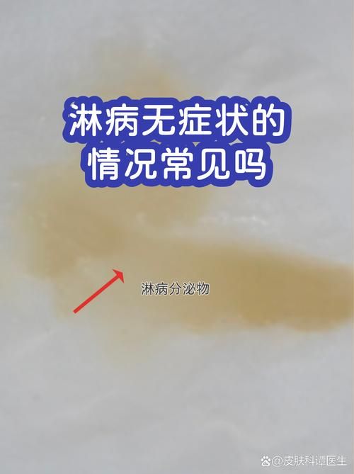 多地新增25例无症状感染者及18例无症状/多地新增无症状感染者病例