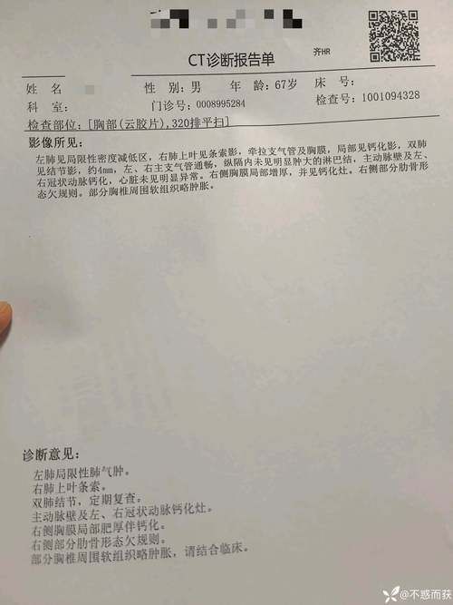 浙江省杭州市临安区最新通告：所有人员足不出户/浙江杭州市临安区新型肺炎病例