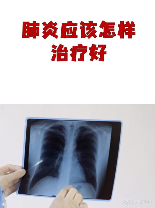 福建省泉州市惠安县现有境外输入29例/福建泉州惠安新型肺炎