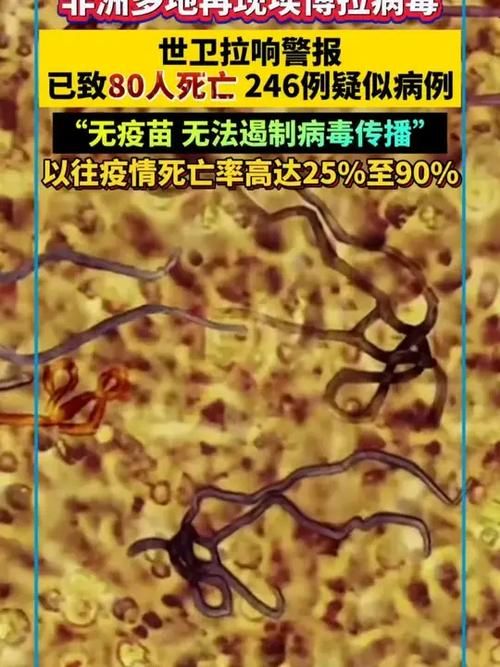 全球新增重症1例均在江西省景德镇市昌江区/景德镇疑似病例