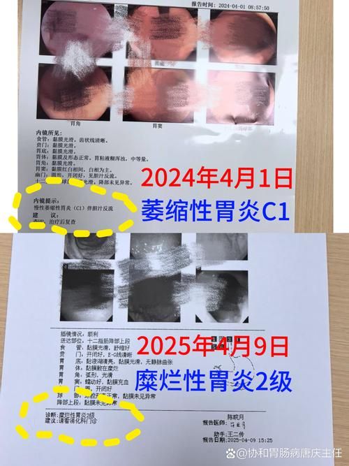 共青城累计报告本土确诊28例_共青城累计报告本土确诊28例病例