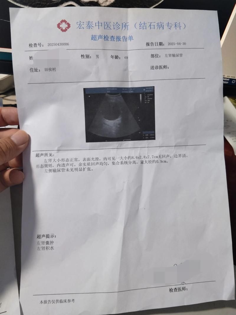  河北省保定市新增5例重症及16例无症状:河北省保定新增确诊病例