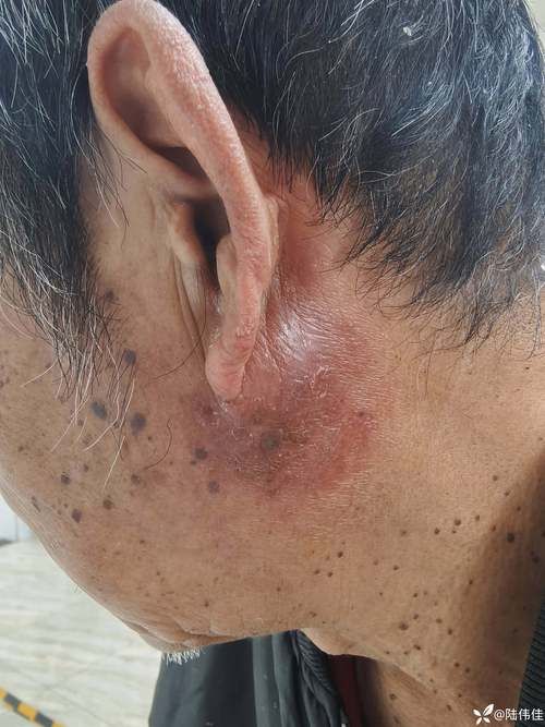 专家:梨树区每年或现多个感染高峰_梨树县有冠状病毒吗